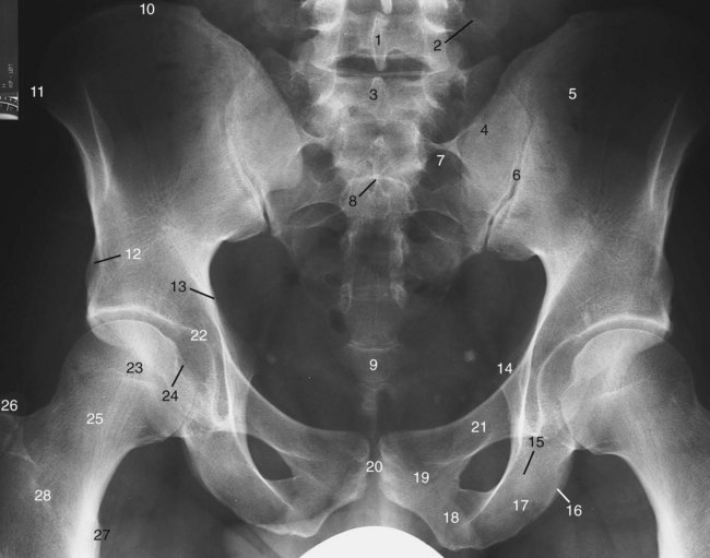 The pelvis | Radiology Key
