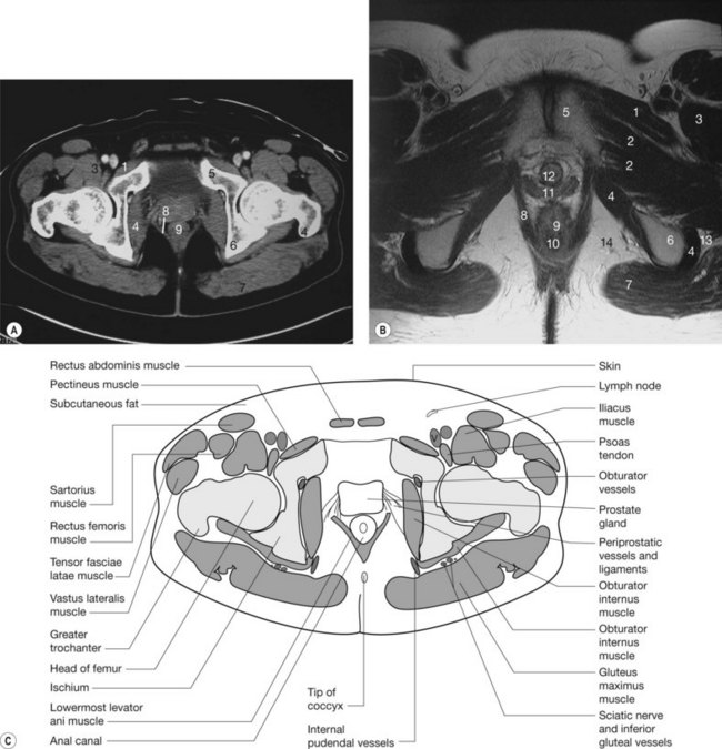 Pelvis Muscles Mri Anatomy The Pelvis Radiology Key Functional