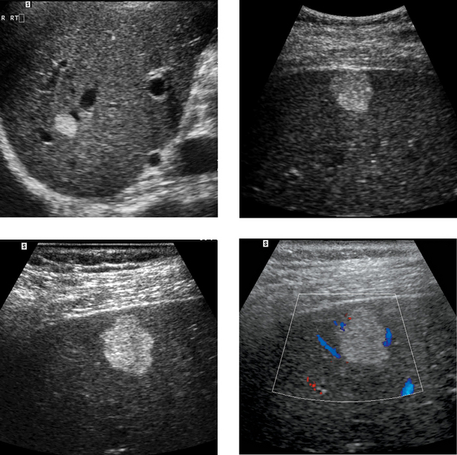 Opening Round | Radiology Key