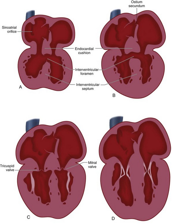 embryologic-basis-and-segmental-approach-to-imaging-of-congenital-heart