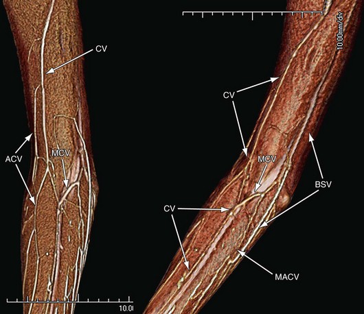arm vein anatomy surface