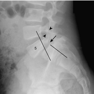 Neuro | Radiology Key