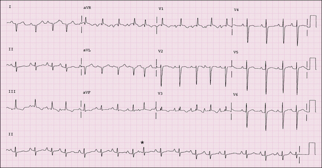 Electrocardiography Radiology Key