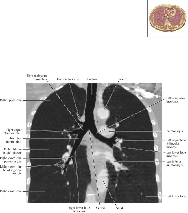 Pulmonary Anatomy and Variants | Radiology Key