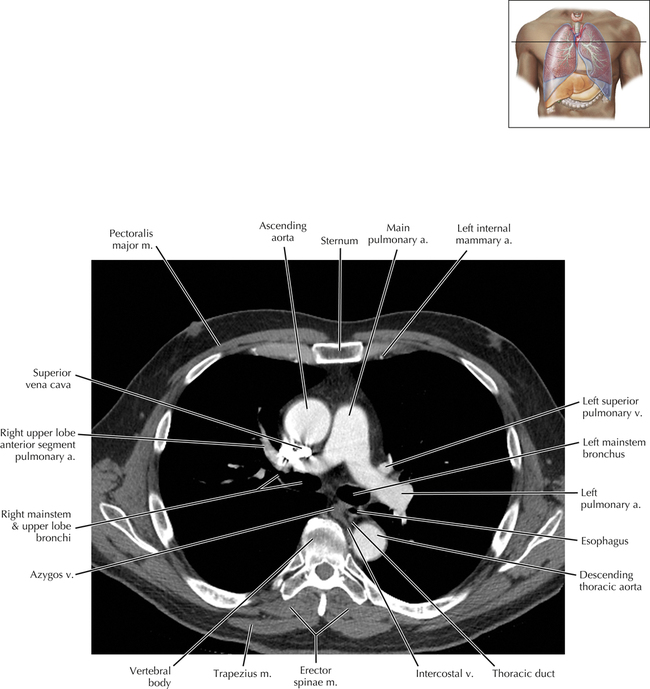 Cisterna Chyli and Thoracic Duct | Radiology Key