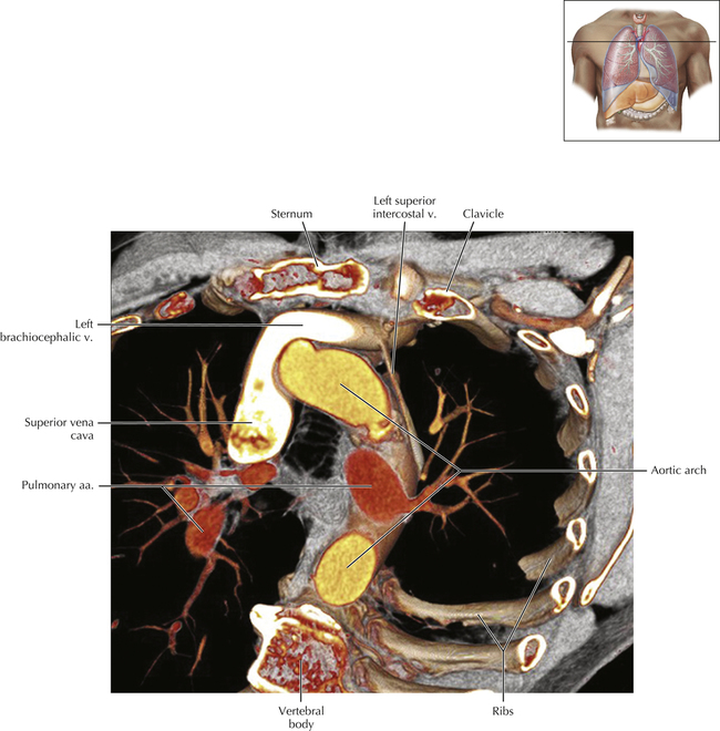 Venous Anatomy and Variants | Radiology Key