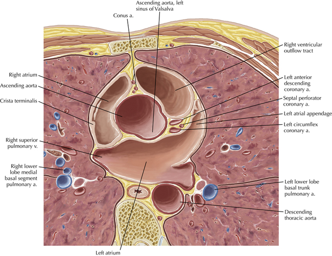 Cardiac Anatomy Using CT | Radiology Key