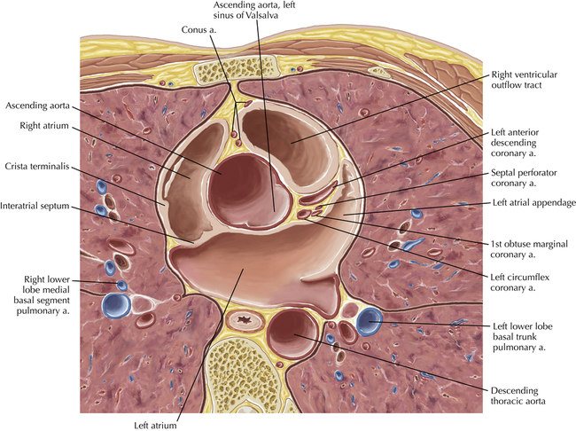 Cardiac Anatomy Using CT | Radiology Key