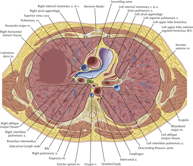 Thoracic Soft Tissue and Lung | Radiology Key