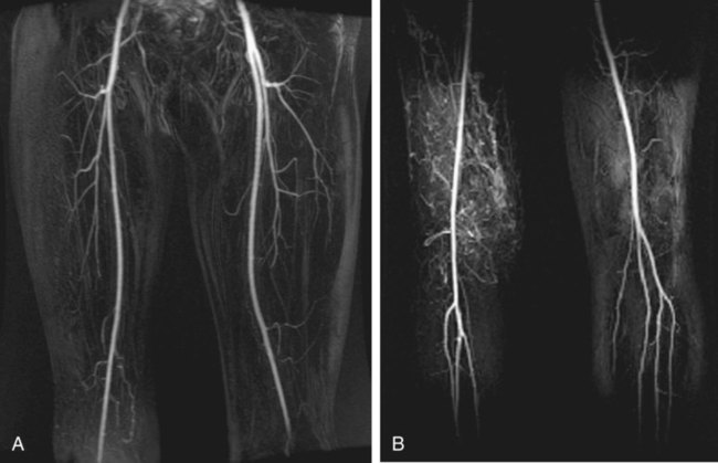 Anatomy Of The Lower Limb | Radiology Key