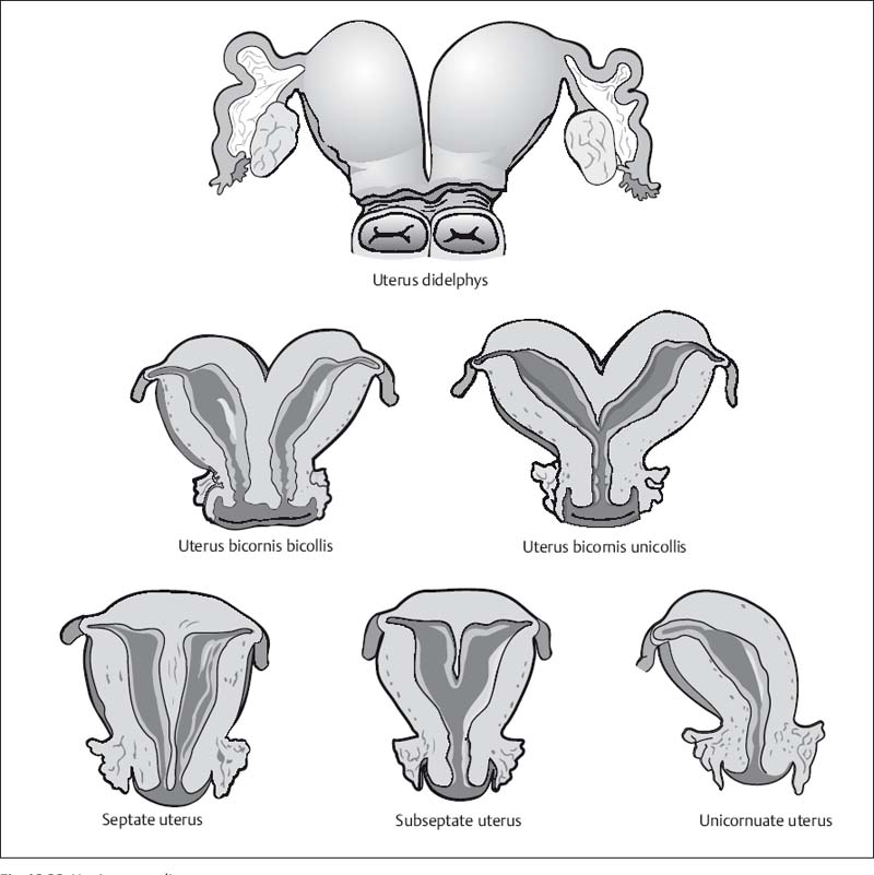 The Uterus And Vagina Radiology Key The Uterus And Vagina Radiology Key