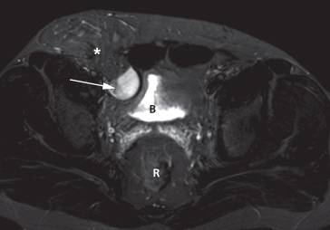 Urinary Tract | Radiology Key