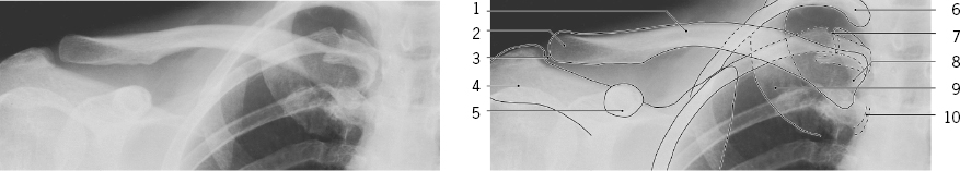 cmp06-fig-5003