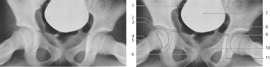 cmp12-fig-5136