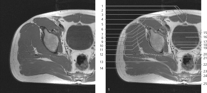 cmp12-fig-5140