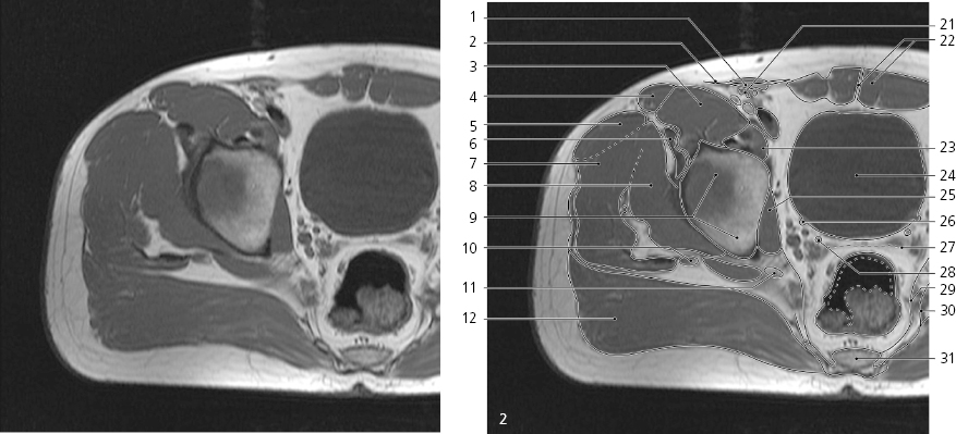 cmp12-fig-5141