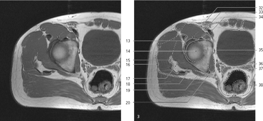 cmp12-fig-5142