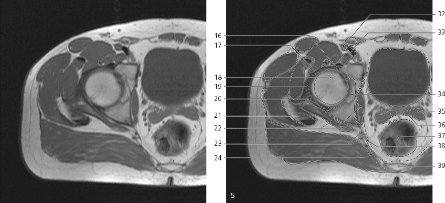 cmp12-fig-5144