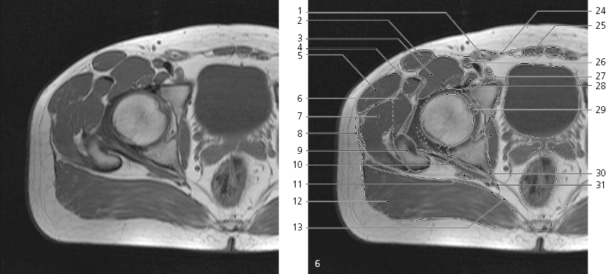 cmp12-fig-5145