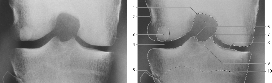 cmp13-fig-5166