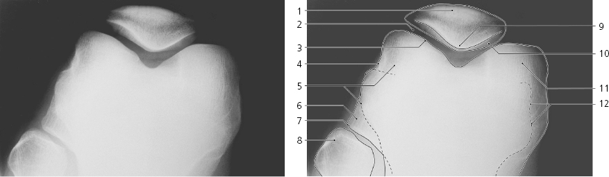 cmp13-fig-5167