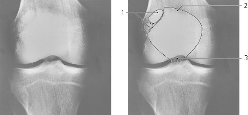 cmp13-fig-5168