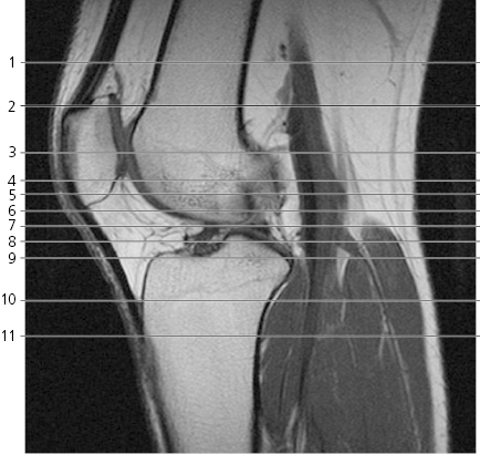 cmp13-fig-5173