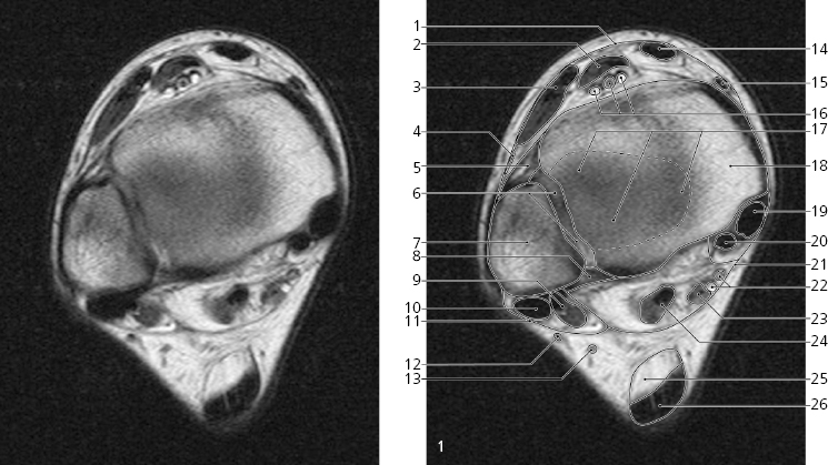 cmp15-fig-5227