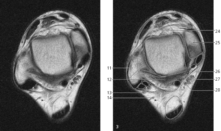 cmp15-fig-5229