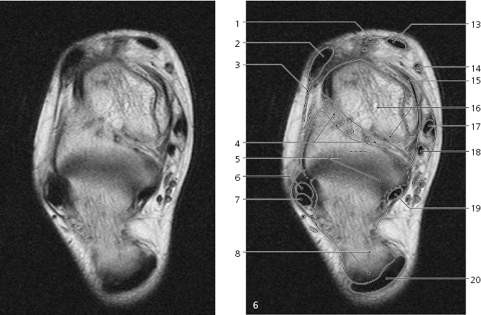 cmp15-fig-5232