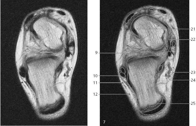 cmp15-fig-5233