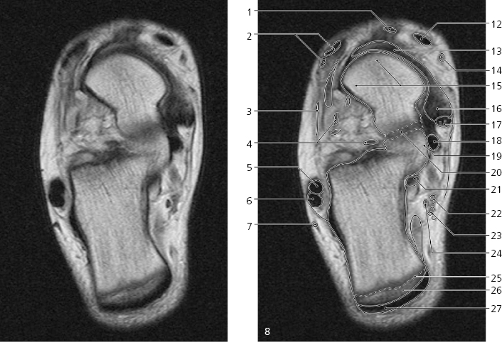 cmp15-fig-5234