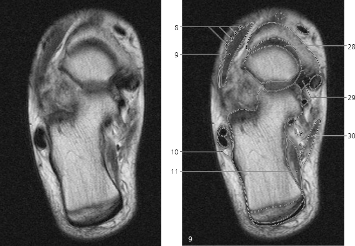 cmp15-fig-5235