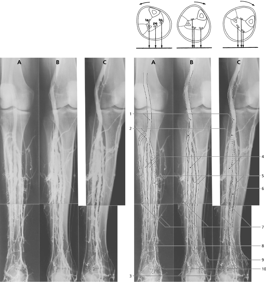 And Veins Radiology Key