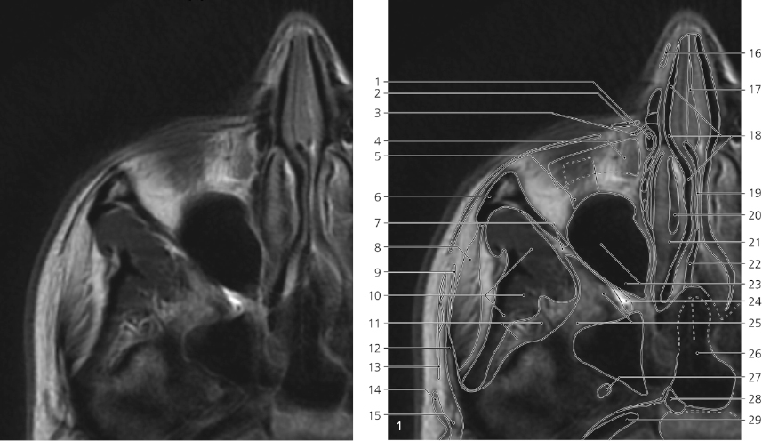 cmp23-fig-5366