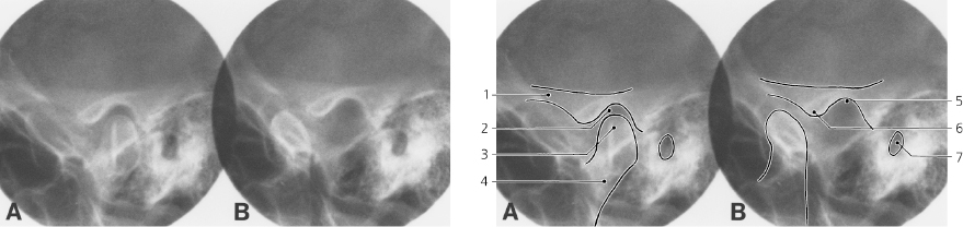 cmp25-fig-5385