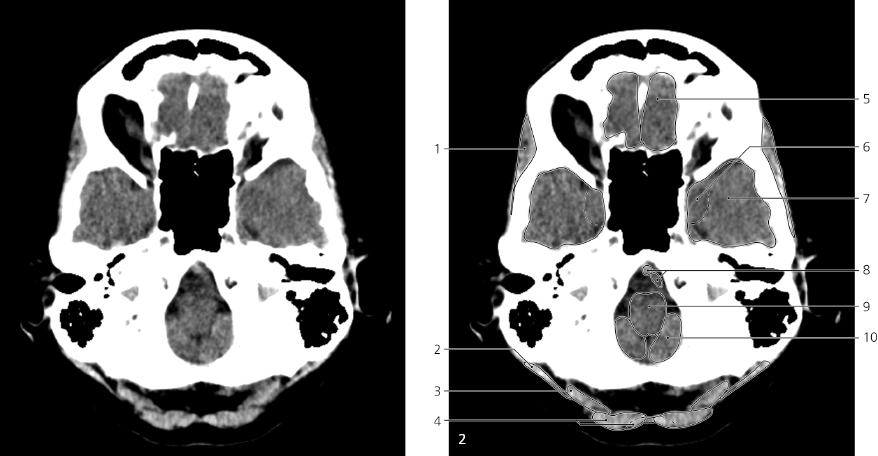 cmp29-fig-5398