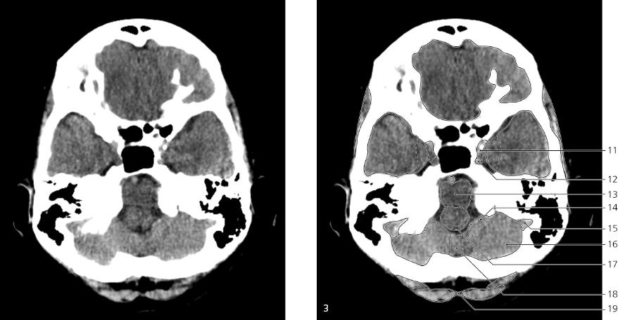 cmp29-fig-5399