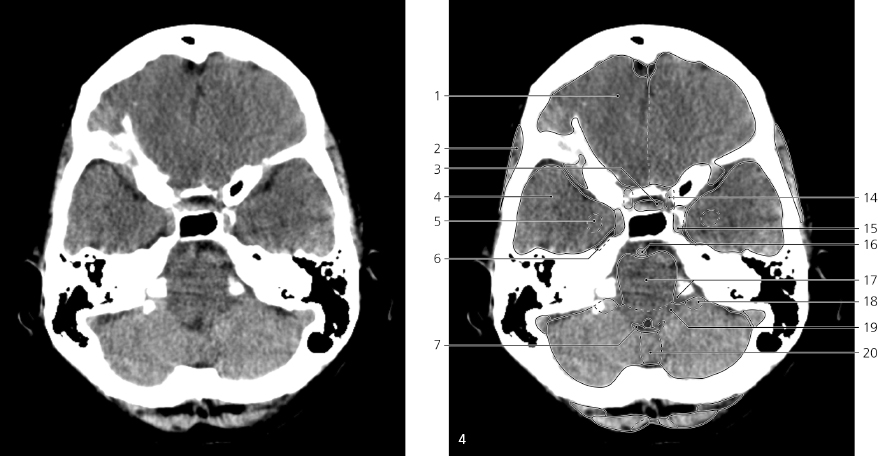 cmp29-fig-5400