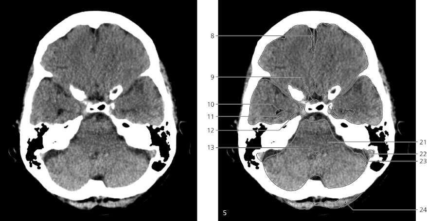 cmp29-fig-5401