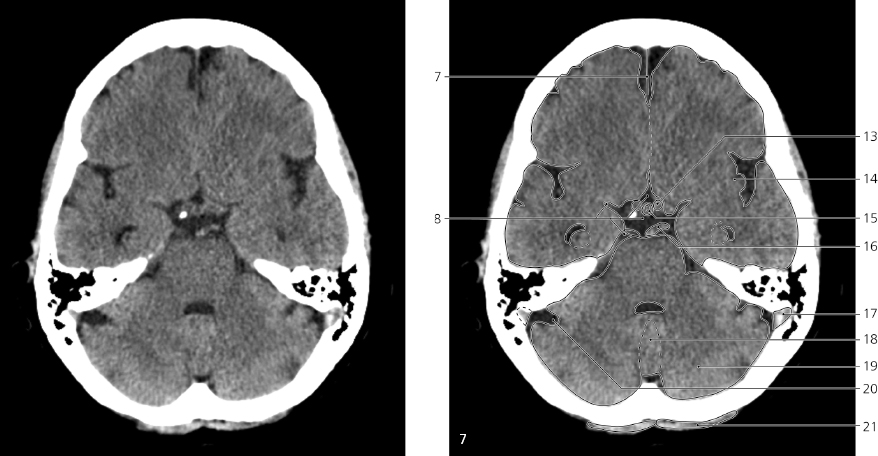 cmp29-fig-5403