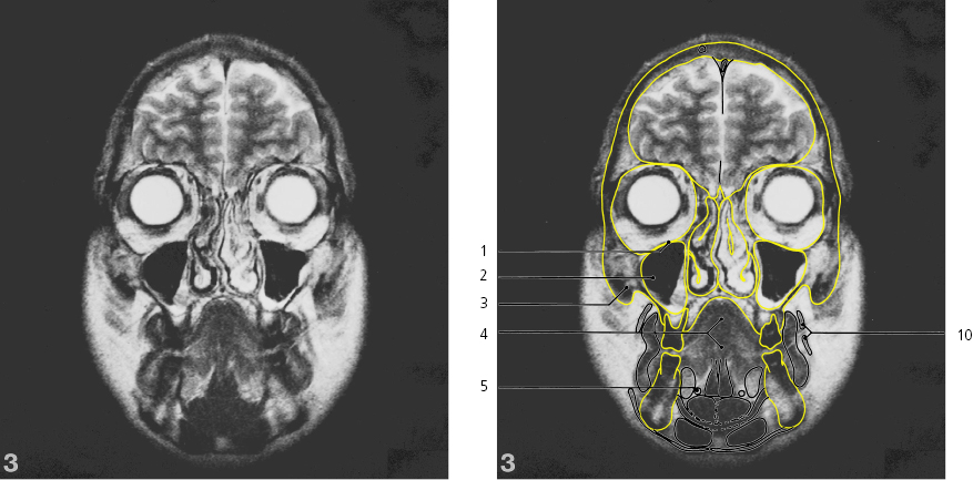 cmp31-fig-5464