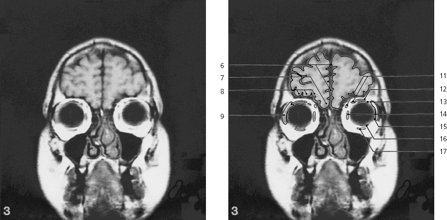 cmp31-fig-5465