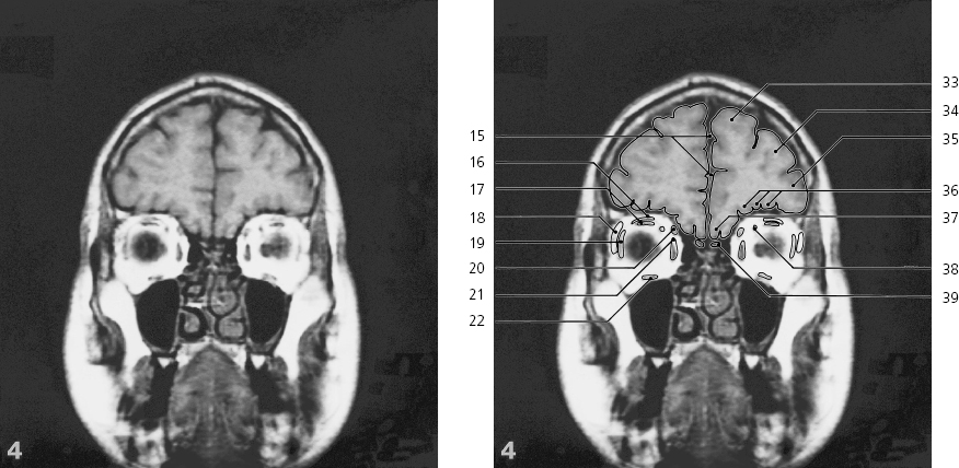 cmp31-fig-5467