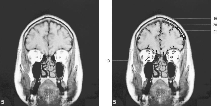 cmp31-fig-5469