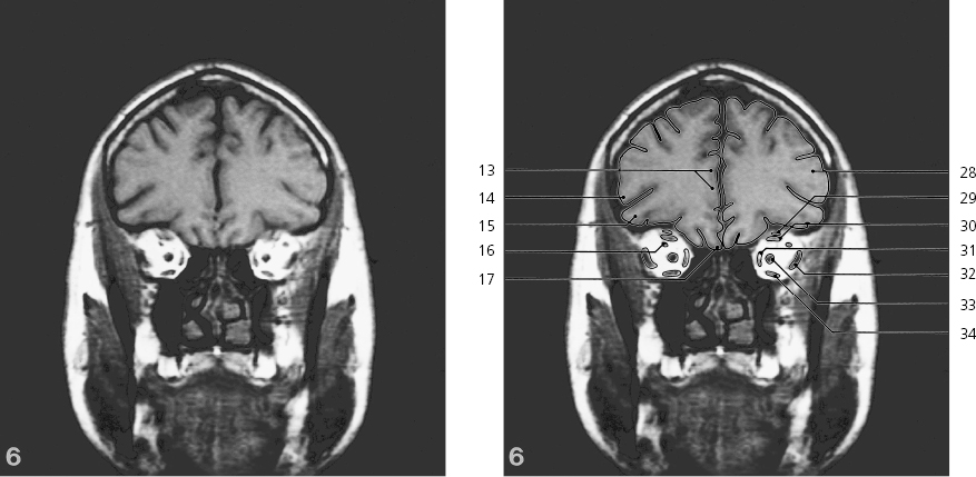 cmp31-fig-5471