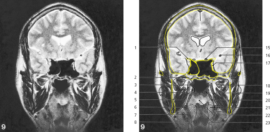 cmp31-fig-5476