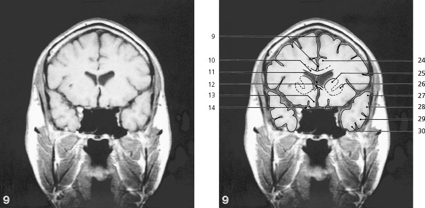 cmp31-fig-5477