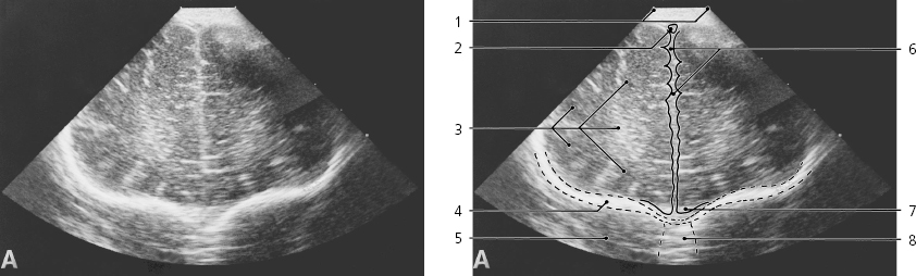 cmp34-fig-5571