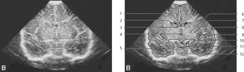 cmp34-fig-5572